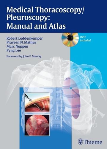 Medical Thoracoscopy / Pleuroscopy: Manual and Atlas (Hardback)