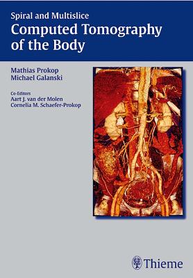 Spiral and Multislice Computed Tomography of the Body (Hardback)