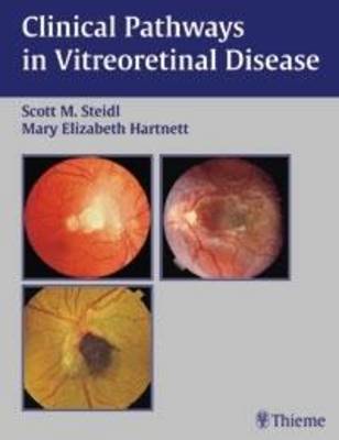 Clinical Pathways in Vitreoretinal Disease (Hardback)