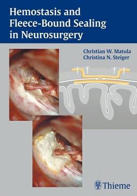 Haemostasis and Fleece-bound Sealing in Neurosurgery (Hardback)