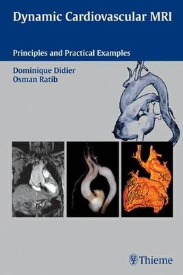 Dynamic Cardiovascular Mri: Principles and Practical Examples (Hardback)