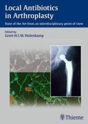 Local Antibiotics in Arthroplasty: State of the Art from an Interdisciplinary Point of View (Paperback)