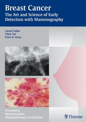 Breast Cancer: The Art and Science of Early Detection with Mammography - Tabar Mammo (Hardback)