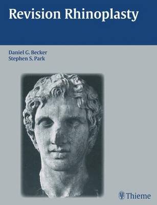 Revision Rhinoplasty (Hardback)
