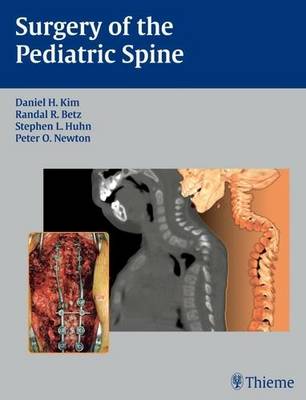 Surgery of the Pediatric Spine (Hardback)