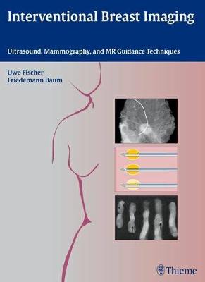 Interventional Breast Imaging: Ultrasound, Mammography, and MR Guidance Techniques (Hardback)
