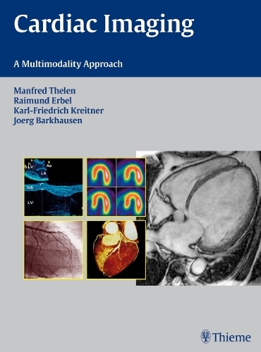 Cardiac Imaging: A Multimodality Approach (Hardback)