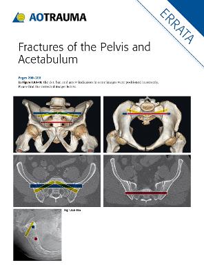Fractures of the Pelvis and Acetabulum (AO) by Marvin Tile, David