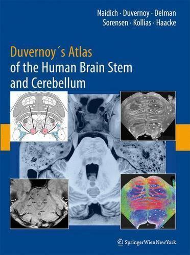 Duvernoy's Atlas of the Human Brain Stem and Cerebellum by Thomas