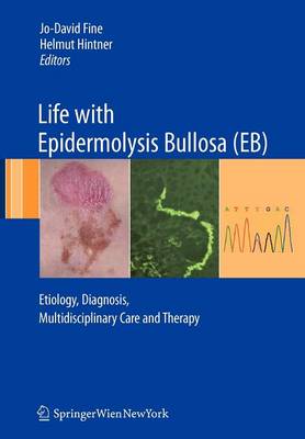 Life with Epidermolysis Bullosa (EB): Etiology, Diagnosis, Multidisciplinary Care and Therapy (Paperback)