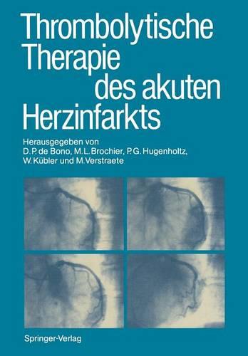 Thrombolytische Therapie des Akuten Herzinfarkts (Paperback)