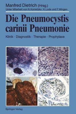 Die Pneumocystis Carinii Pneumonie (Paperback)