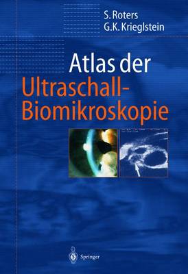 Atlas Der Ultraschall-Biomikroskopie (Hardback)