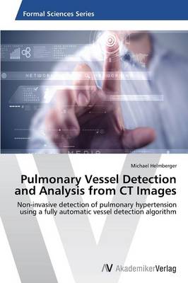 Pulmonary Vessel Detection and Analysis from CT Images (Paperback)