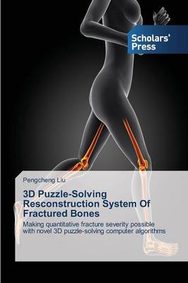 3D Puzzle-Solving Resconstruction System of Fractured Bones (Paperback)