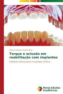 Torque E Oclusao Em Reabilitacao Com Implantes (Paperback)
