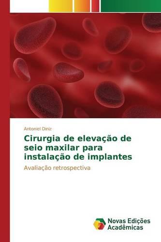 Cirurgia de Elevacao de Seio Maxilar Para Instalacao de Implantes (Paperback)