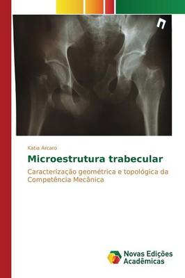 Microestrutura Trabecular (Paperback)