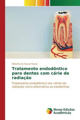Tratamento Endodontico Para Dentes Com Carie de Radiacao (Paperback)