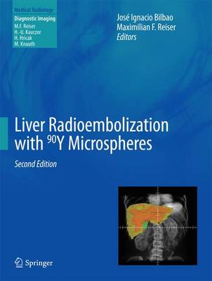 Liver Radioembolization with 90Y Microspheres - Diagnostic Imaging (Hardback)