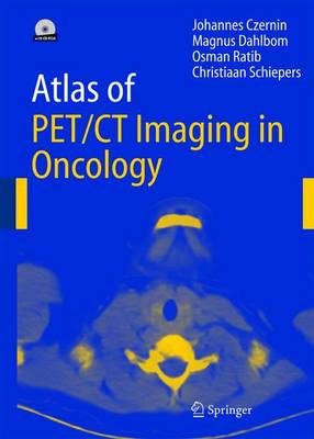 Atlas of PET/CT Imaging in Oncology (Paperback)