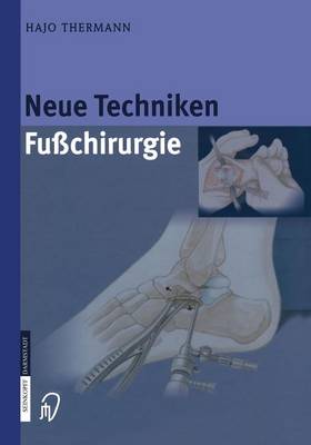 Neue Techniken Fusschirurgie (Paperback)
