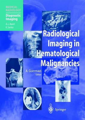 Radiological Imaging in Hematological Malignancies - Medical Radiology (Paperback)