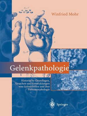 Gelenkpathologie: Historische Grundlagen, Ursachen Und Entwicklungen Von Gelenkleiden Und Ihre Pathomorphologie (Paperback)