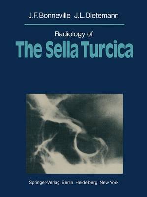 Radiology of The Sella Turcica (Paperback)