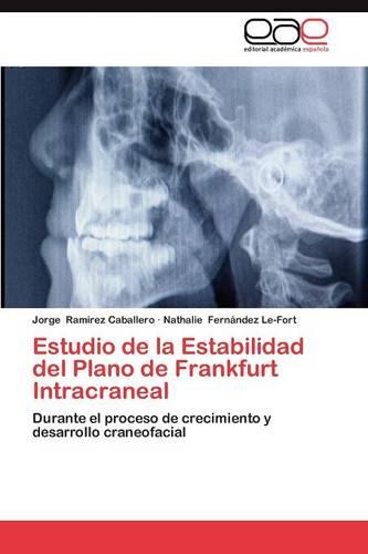 Estudio de La Estabilidad del Plano de Frankfurt Intracraneal (Paperback)