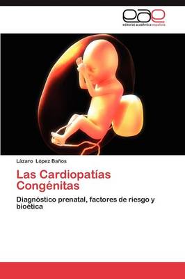 Las Cardiopatias Congenitas (Paperback)