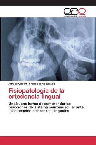 Fisiopatologia de La Ortodoncia Lingual (Paperback)