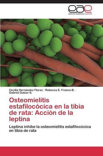 Osteomielitis Estafilococica En La Tibia de Rata: Accion de La Leptina (Paperback)