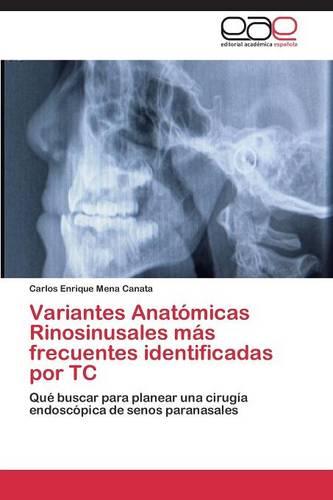 Variantes Anatomicas Rinosinusales Mas Frecuentes Identificadas Por Tc (Paperback)