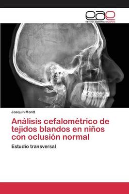 Analisis Cefalometrico de Tejidos Blandos En Ninos Con Oclusion Normal (Paperback)