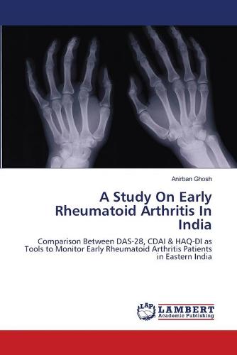 A Study on Early Rheumatoid Arthritis in India (Paperback)