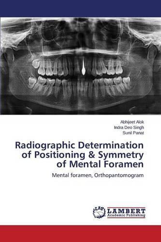 Radiographic Determination of Positioning & Symmetry of Mental Foramen (Paperback)