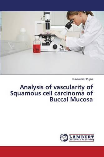 Analysis of Vascularity of Squamous Cell Carcinoma of Buccal Mucosa (Paperback)