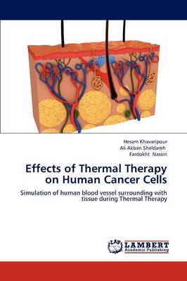 Effects of Thermal Therapy on Human Cancer Cells (Paperback)