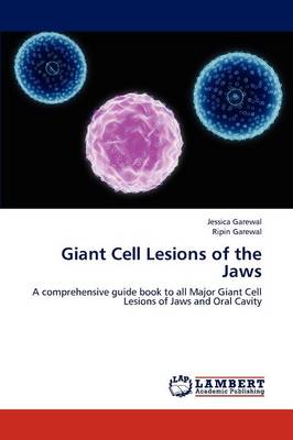 Giant Cell Lesions of the Jaws (Paperback)