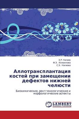 Allotransplantatsiya Kostey Pri Zameshchenii Defektov Nizhney Chelyusti (Paperback)