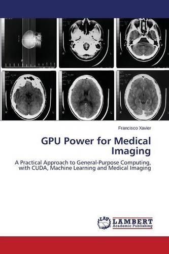 Gpu Power for Medical Imaging (Paperback)