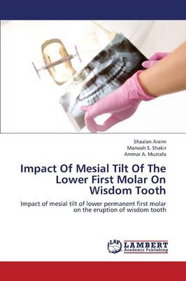 Impact of Mesial Tilt of the Lower First Molar on Wisdom Tooth (Paperback)