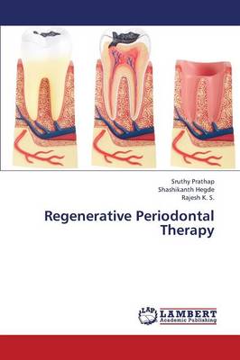 Regenerative Periodontal Therapy (Paperback)