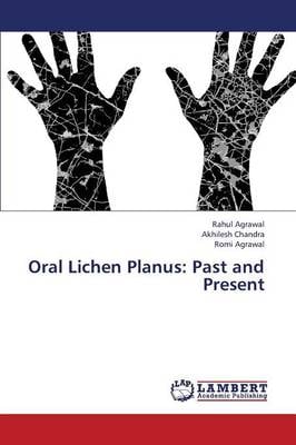 Oral Lichen Planus: Past and Present (Paperback)