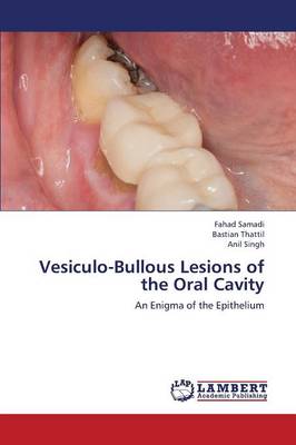 Vesiculo-Bullous Lesions of the Oral Cavity (Paperback)
