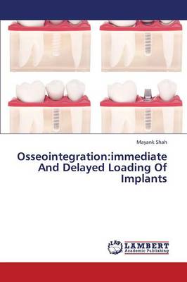 Osseointegration: Immediate and Delayed Loading of Implants (Paperback)