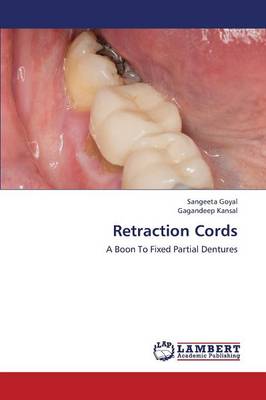 Retraction Cords (Paperback)
