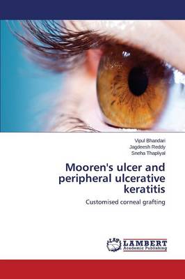 Mooren's Ulcer and Peripheral Ulcerative Keratitis (Paperback)