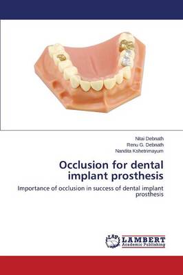 Occlusion for Dental Implant Prosthesis (Paperback)